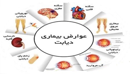 11 درصد افراد بالای 25 سال در ایران مبتلا به دیابت نوع 2 هستند