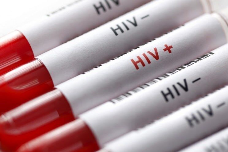ابتلای بیش از ۲۳ هزار نفر به اچ‌آی‌وی/ایدز در کشور